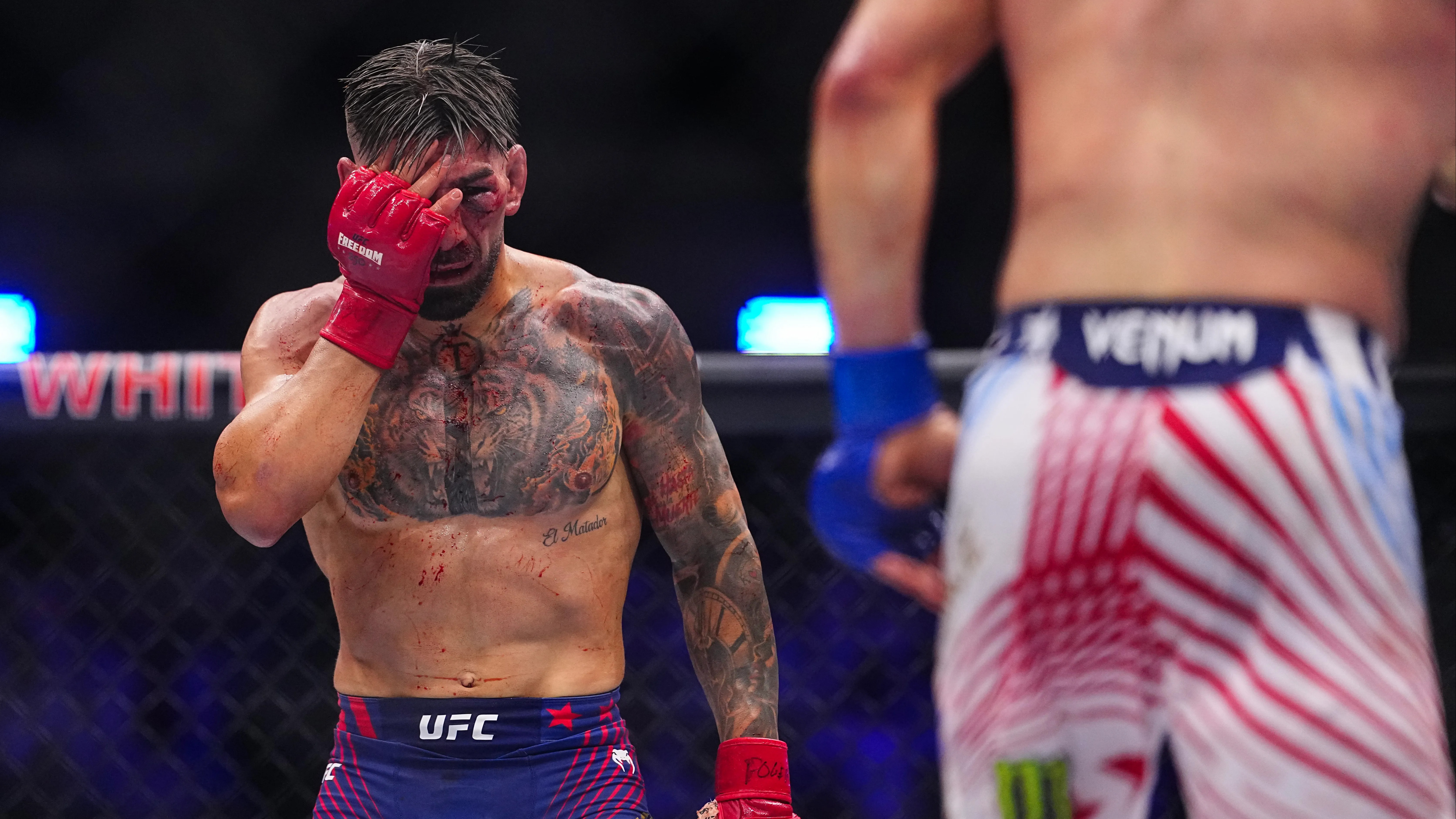 Ilia Topuria's Shocking Revelation: Blinded in UFC Loss to Justin Gaethje (2026)