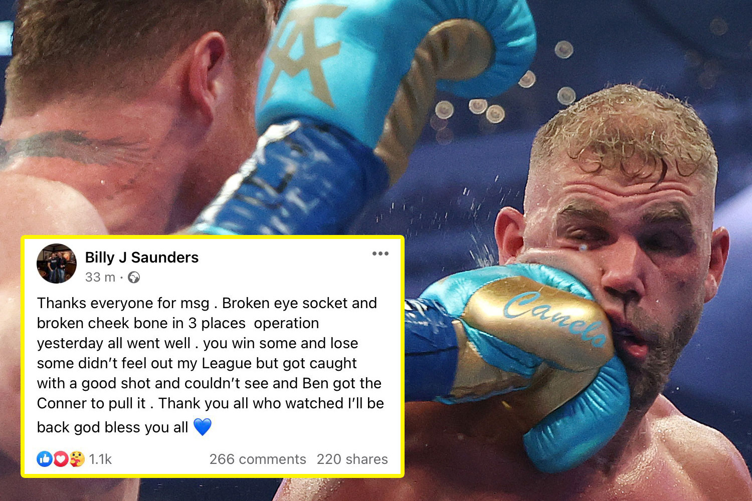 images Canelo Vs Saunders Eye Injury talksport