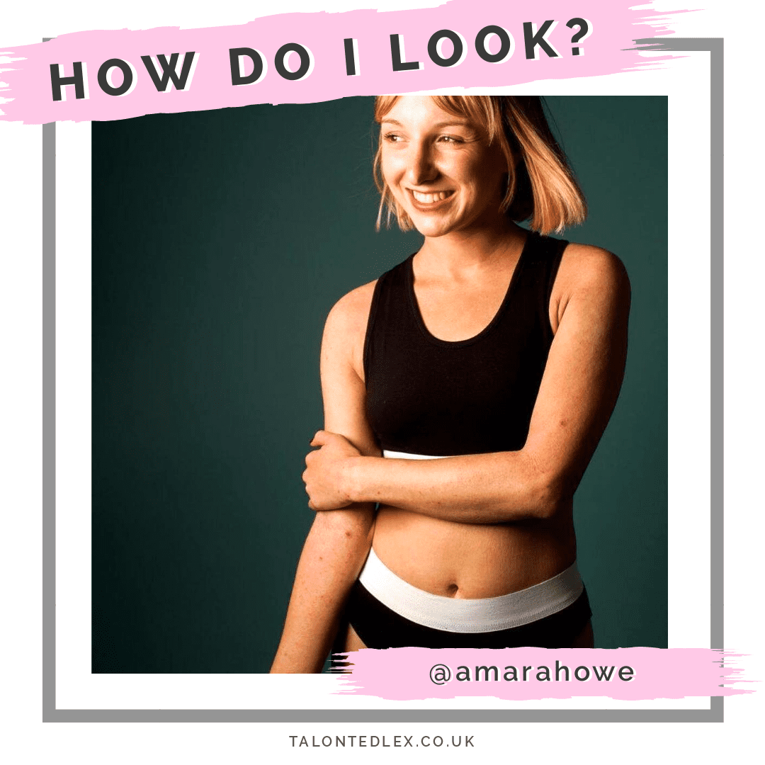 An interview about living with eczema. We chat skin positivity, eczema in the media, and the impact of skin conditions on mental health. Amara shares her eczema tips and advice. #talontedlex #eczematips #eczemaadvice