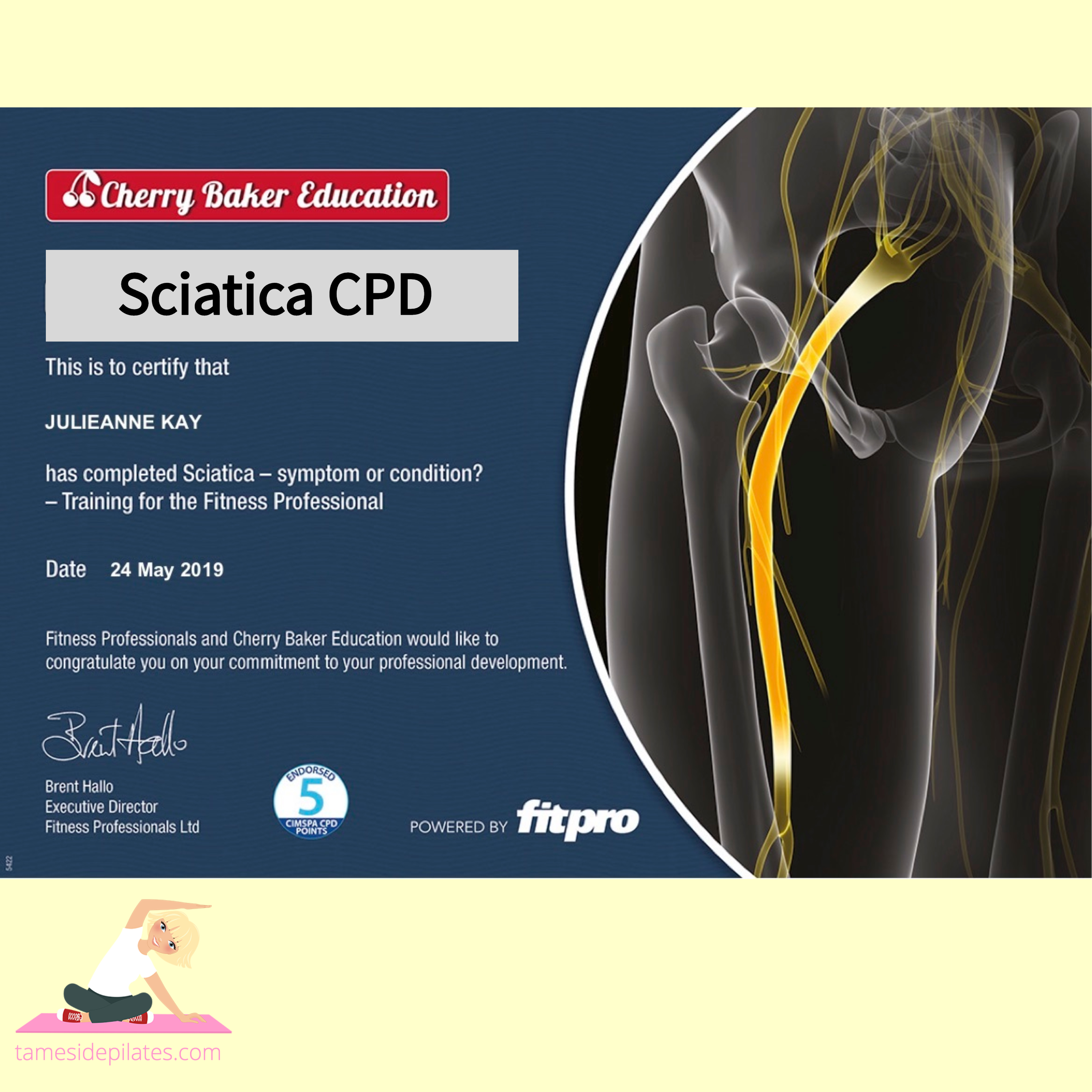 sciatica