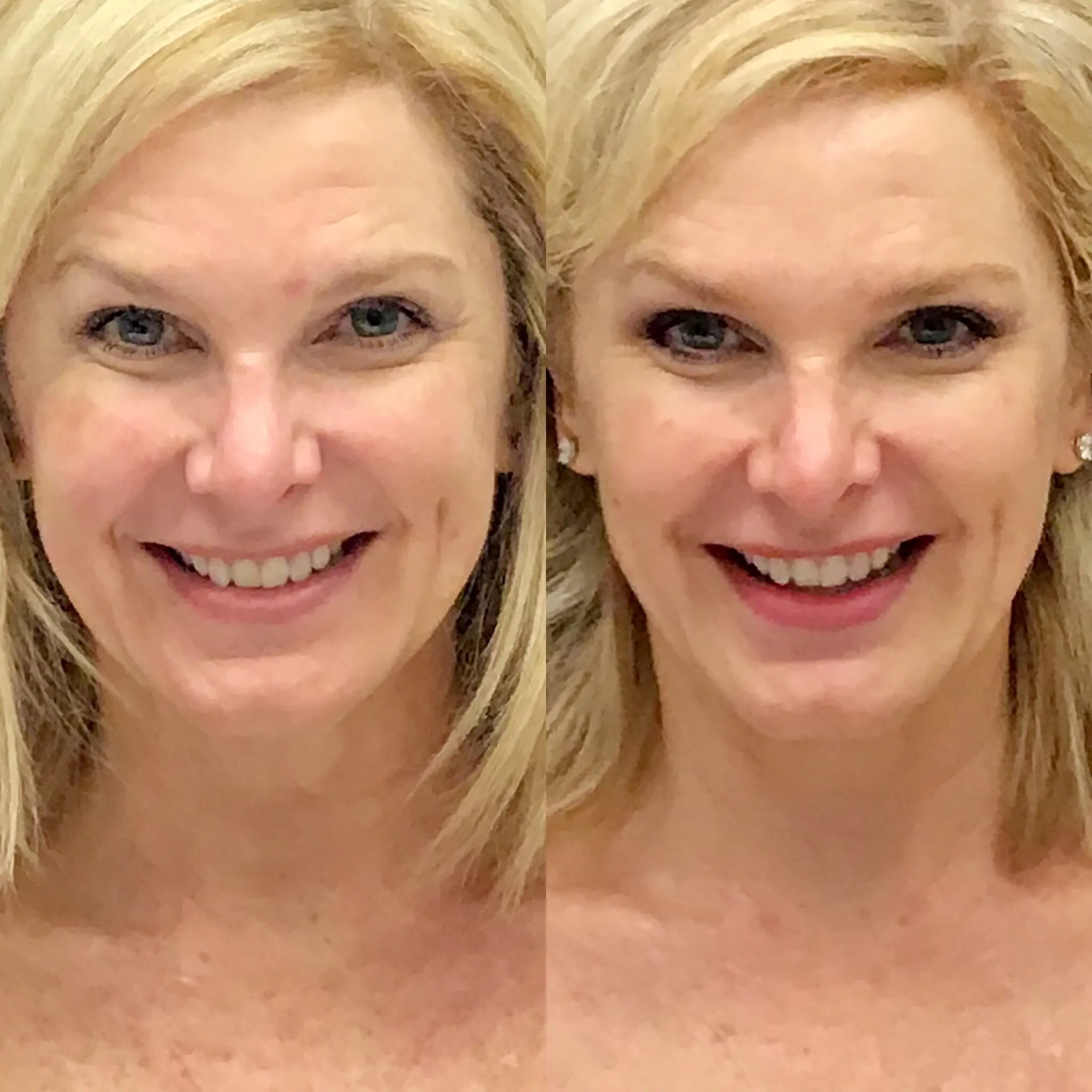 forma facial near me