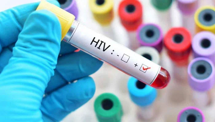 Govt reinforces HIV/AIDS interventions