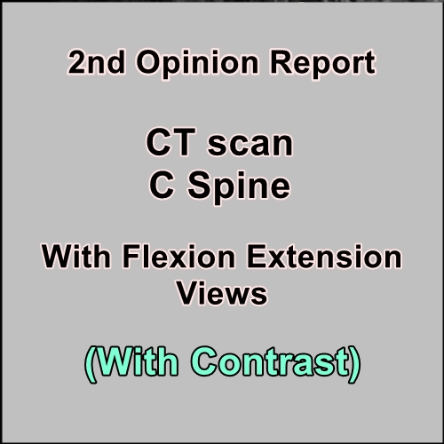 CT scan C Spine with Flexion Extension (With Contrast) – Target Radiology