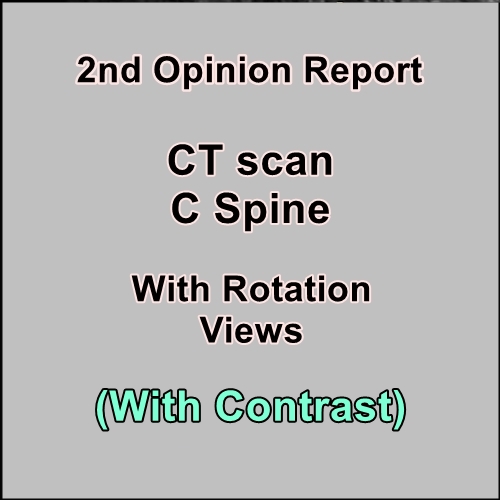 CT scan C Spine with Rotation Views (With Contrast) Target Radiology