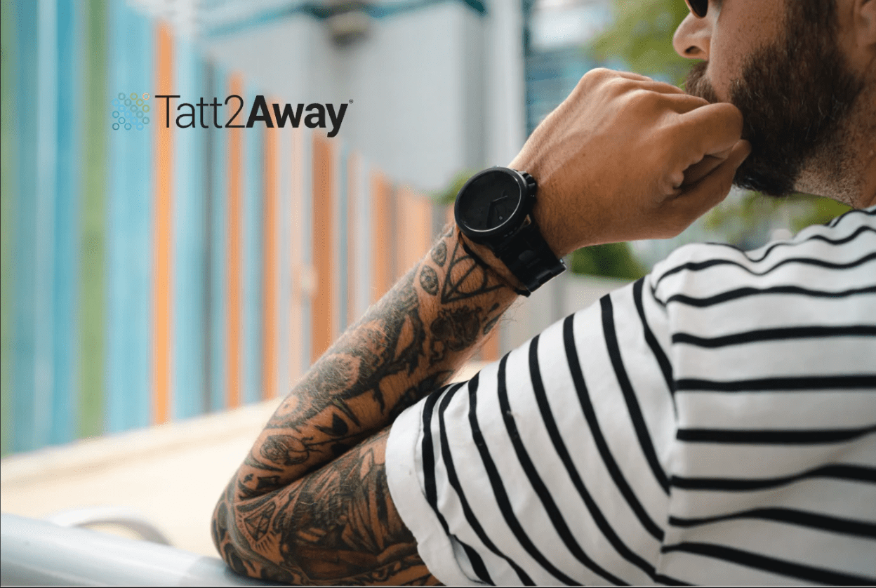 Finger tattoo removal services