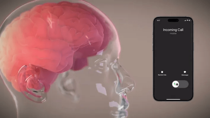 Neuralink User Plays World of Warcraft Using Only Thoughts