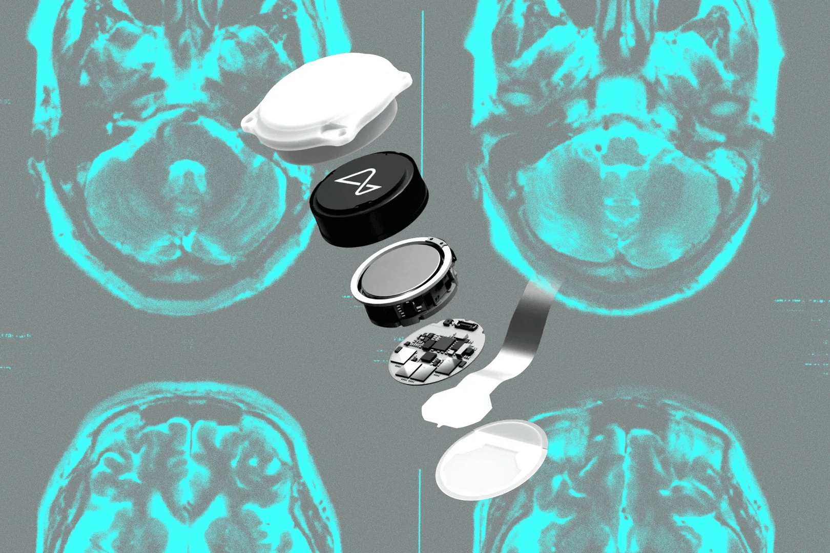 Did Neuralink make the wrong bet?
