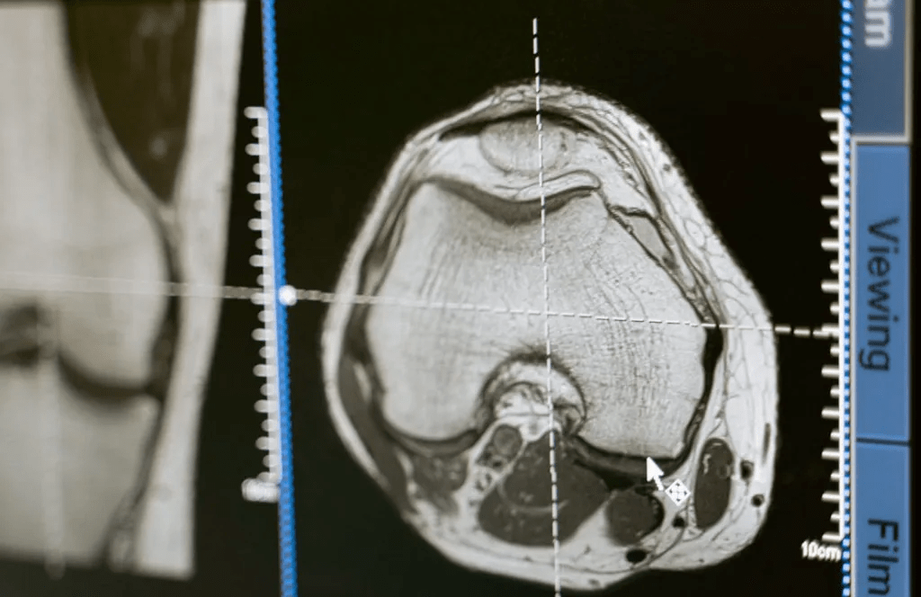 Quantum-Enhanced MRI Project Aims to Improve Early Cancer Detection
