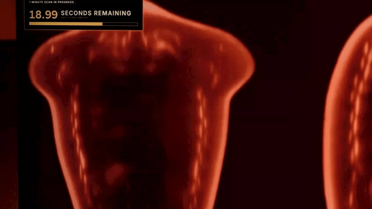 Remember Midjourney? It’s Building a Medical Scanning Device That It Says Is Faster Than an MRI