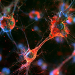 Peripheral Blood Cells Replenish Aging Human Microglia
