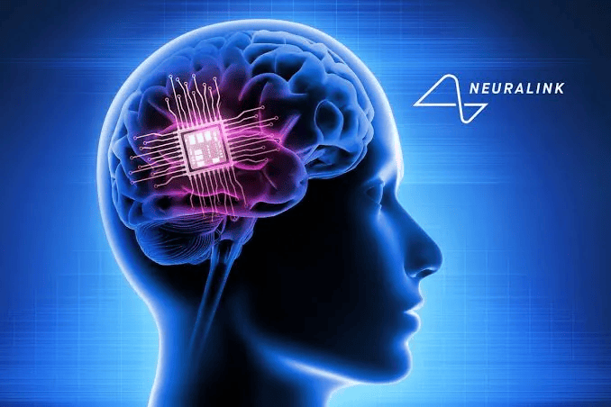 Neuralink Enables Individual With Speech Impairment To Communicate Using Thoughts