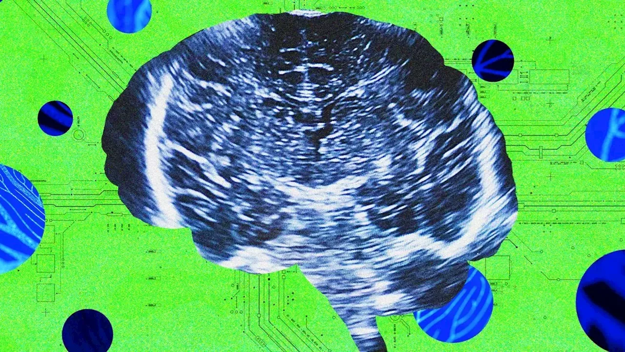 A New Neurotech Startup Launches to Rival Sam Altman’s Merge Labs