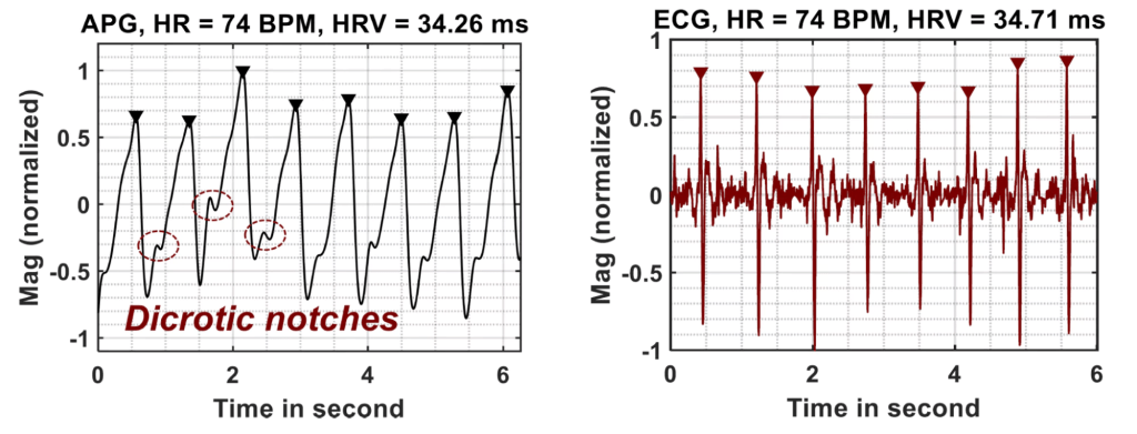 APG signal used in the measurement phase 