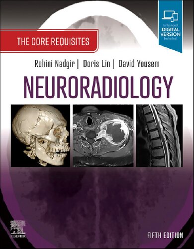 Neuroradiology - The Core Requisites (5th Edition) Format: PDF eTextbooks ISBN-13: 978-0323759755 ISBN-10: 0323759750 Delivery: Instant Download Authors: Rohini Nadgir MD  Publisher: Elsevier