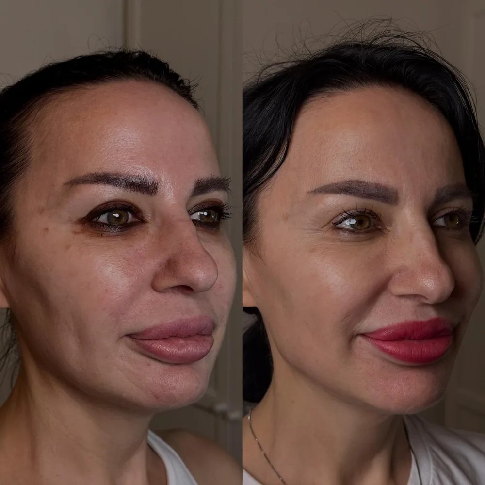 Full face regenerative