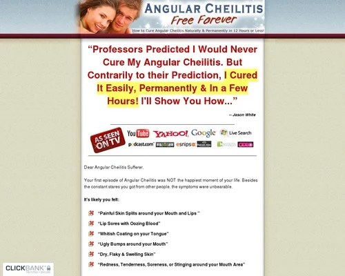 Angular Cheilitis Free Forever ~ Great Niche With No Competition!
