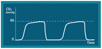 etco2-waveforms-i4