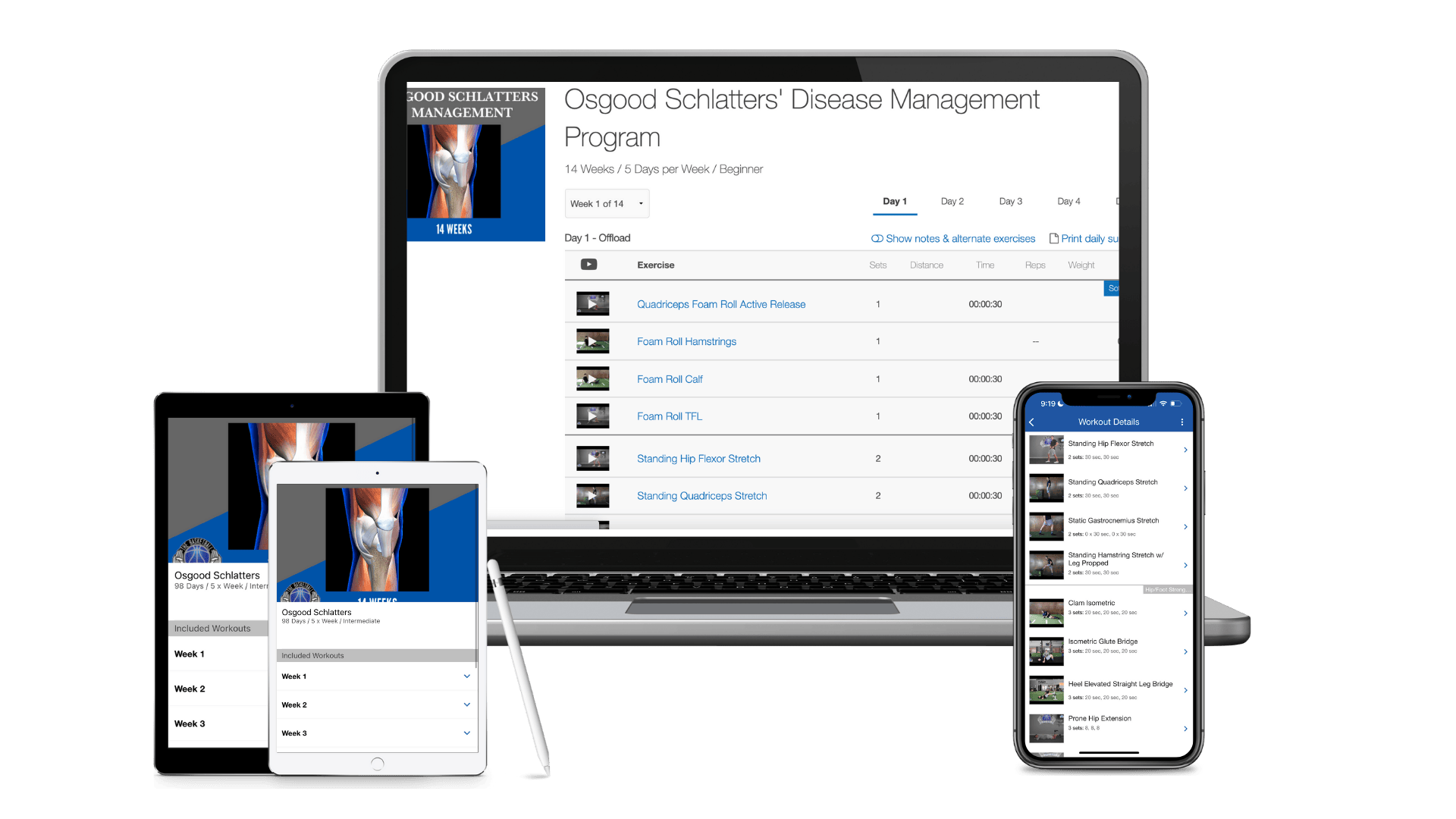 Osgood Schlatter's Disease Management Program