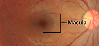 square box marks macula location