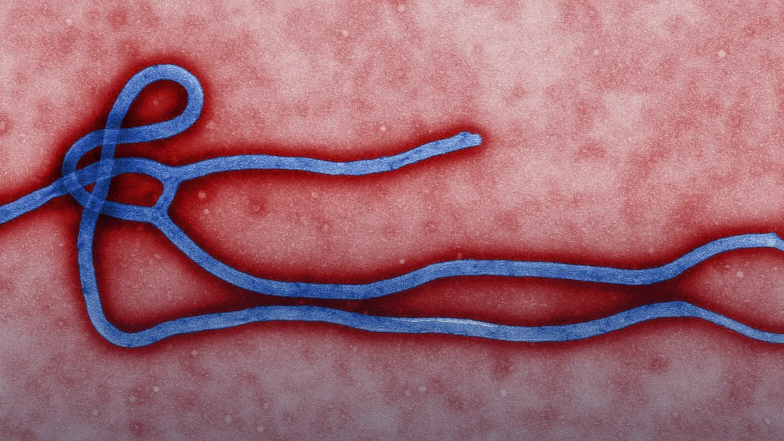 Kenya Ebola Case: Bundibugyo Death Spurs Contact Tracing