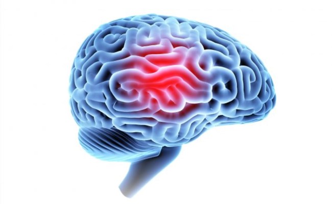 What You Should Know About Traumatic Brain Injuries (TBI) - The Brain ...