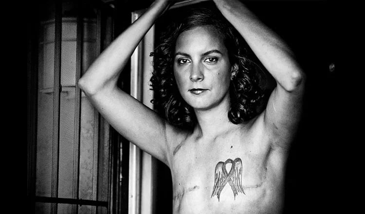 The Imperfect Beauty Of Scars: The SCAR Project - Because Cancer Is Not A Pink Ribbon