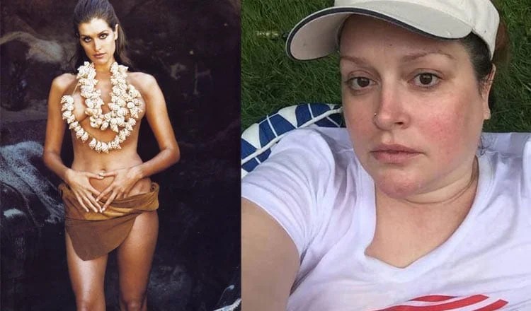 James Packer’s ex Kate Fischer Hits Back At Fat-Shaming Pics1