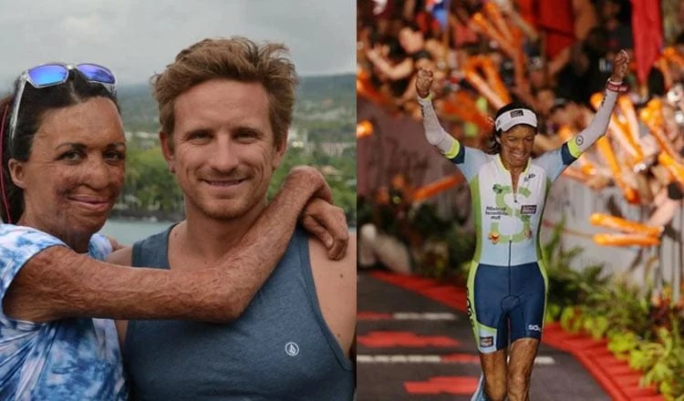 Burns Survivor Turia Pitt Finishes World’s Toughest Triathlon1