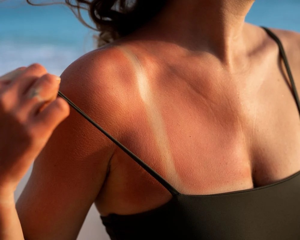 TikTok Tanning Trend