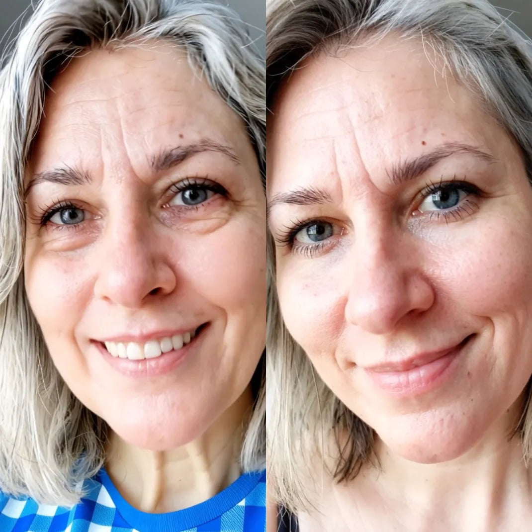 Arlene W. Before and After