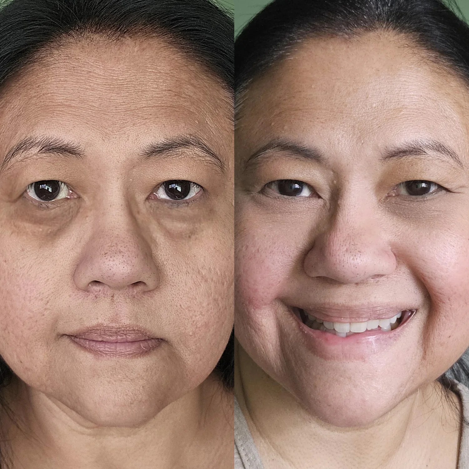 Before and after - Gabrielle