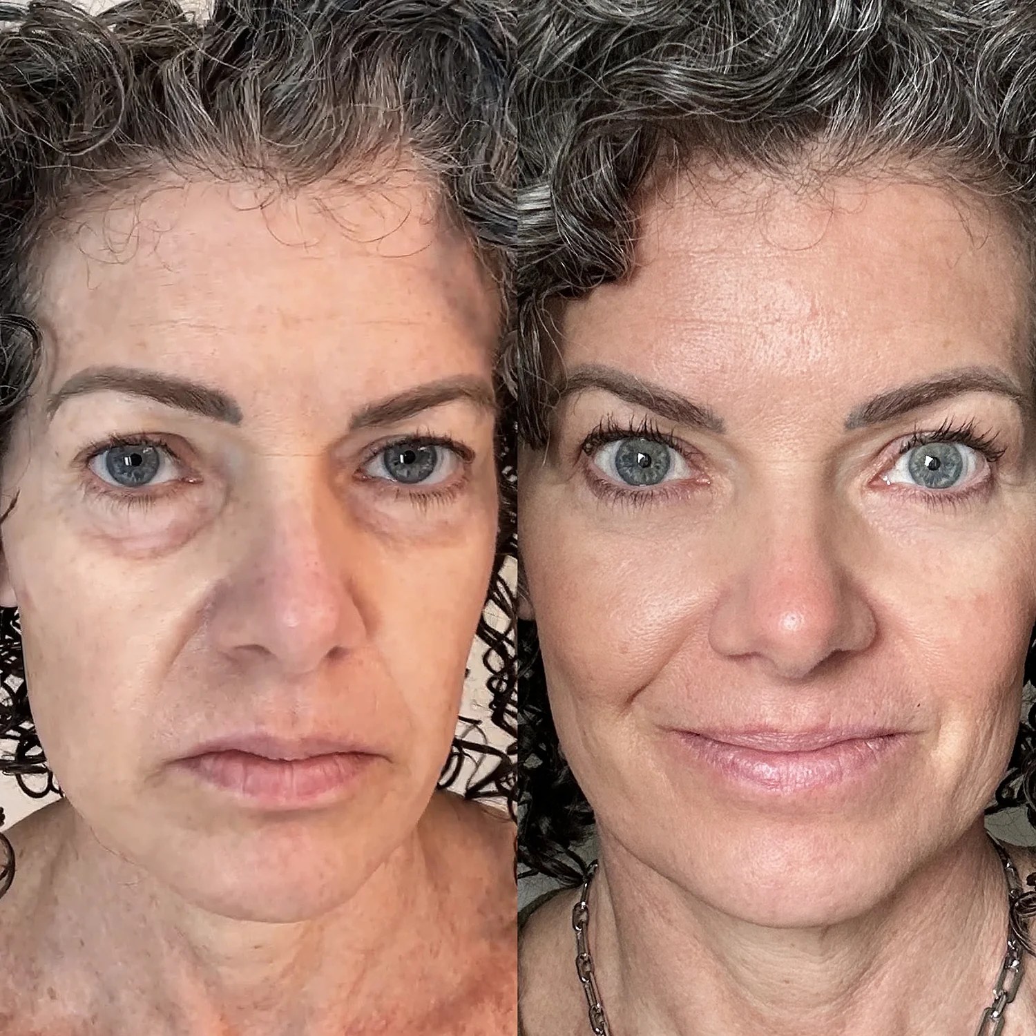 Before and after results