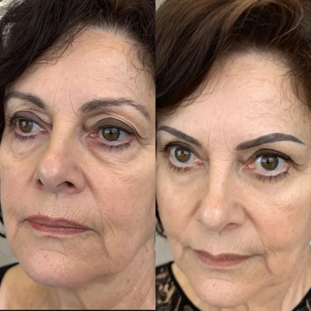 Before and After Results