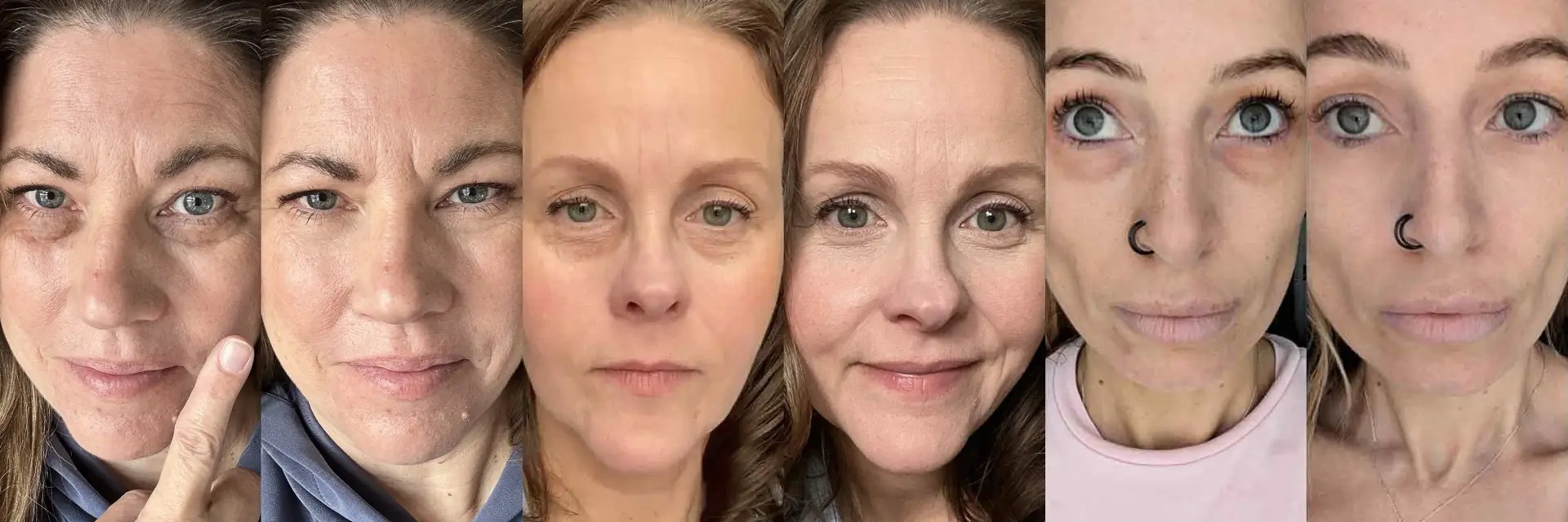 Under-eye solution comparison