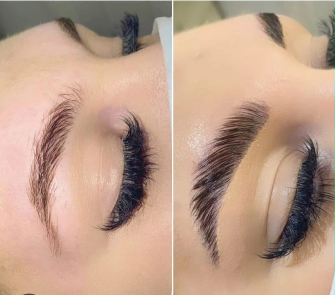 Brow shaping