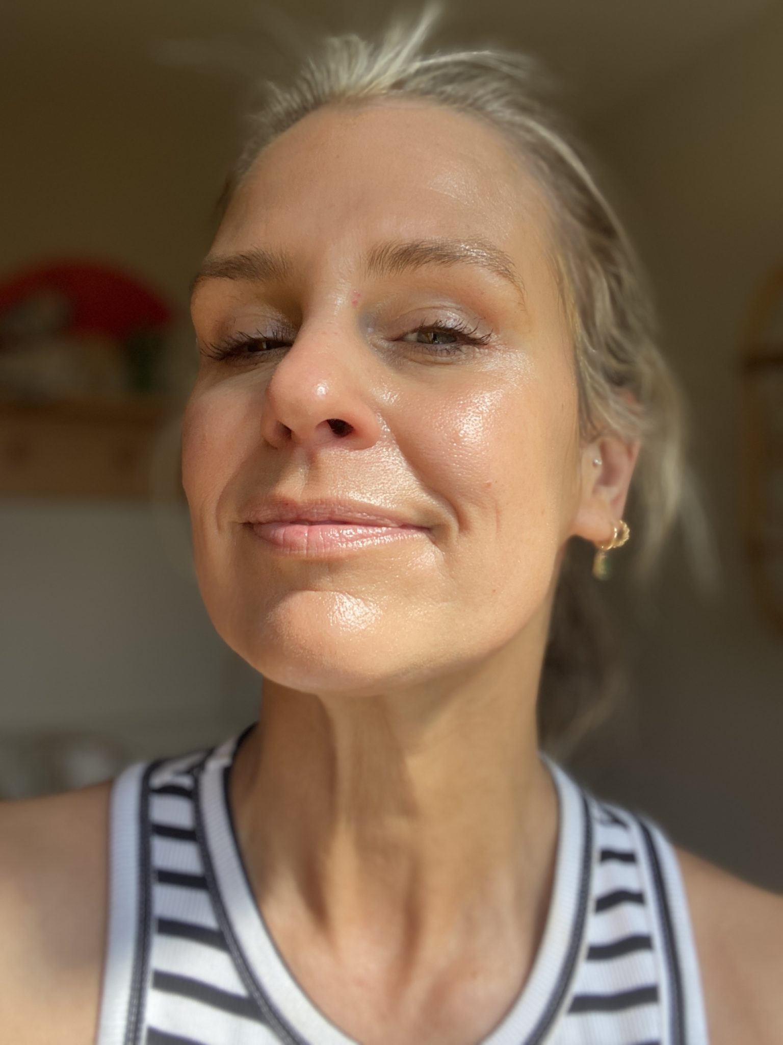 My Skin now - sorry for the funny angle!