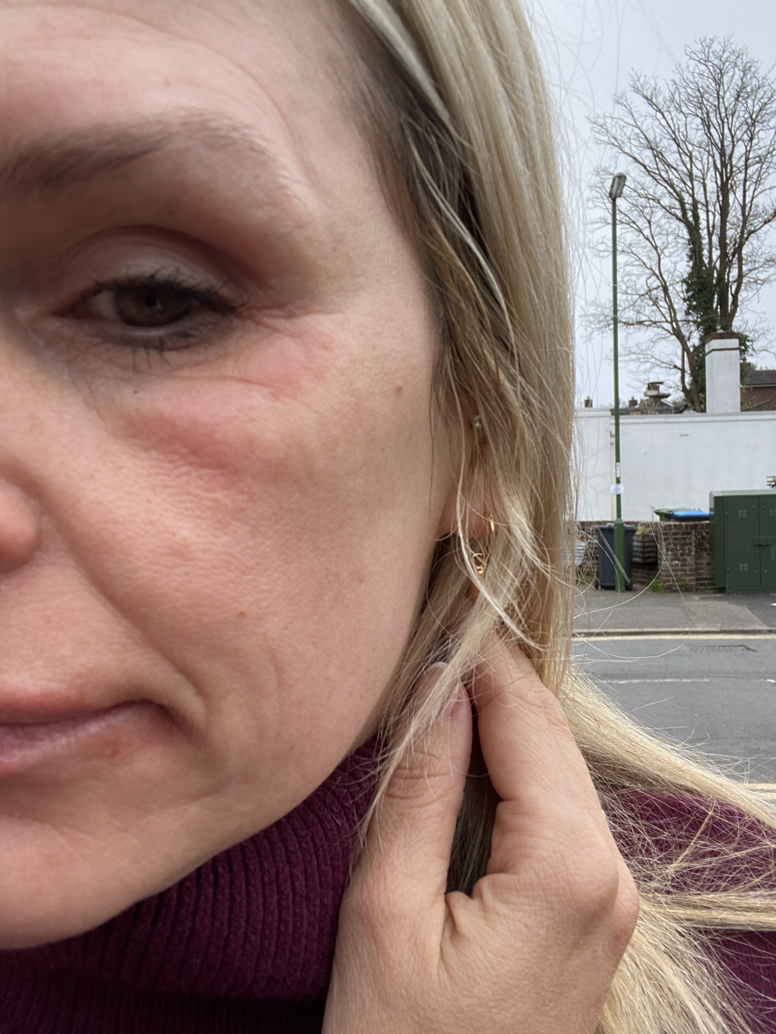 image of face showing irritation