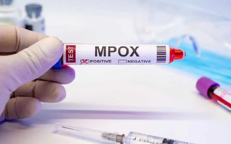 Empox confirmed in India