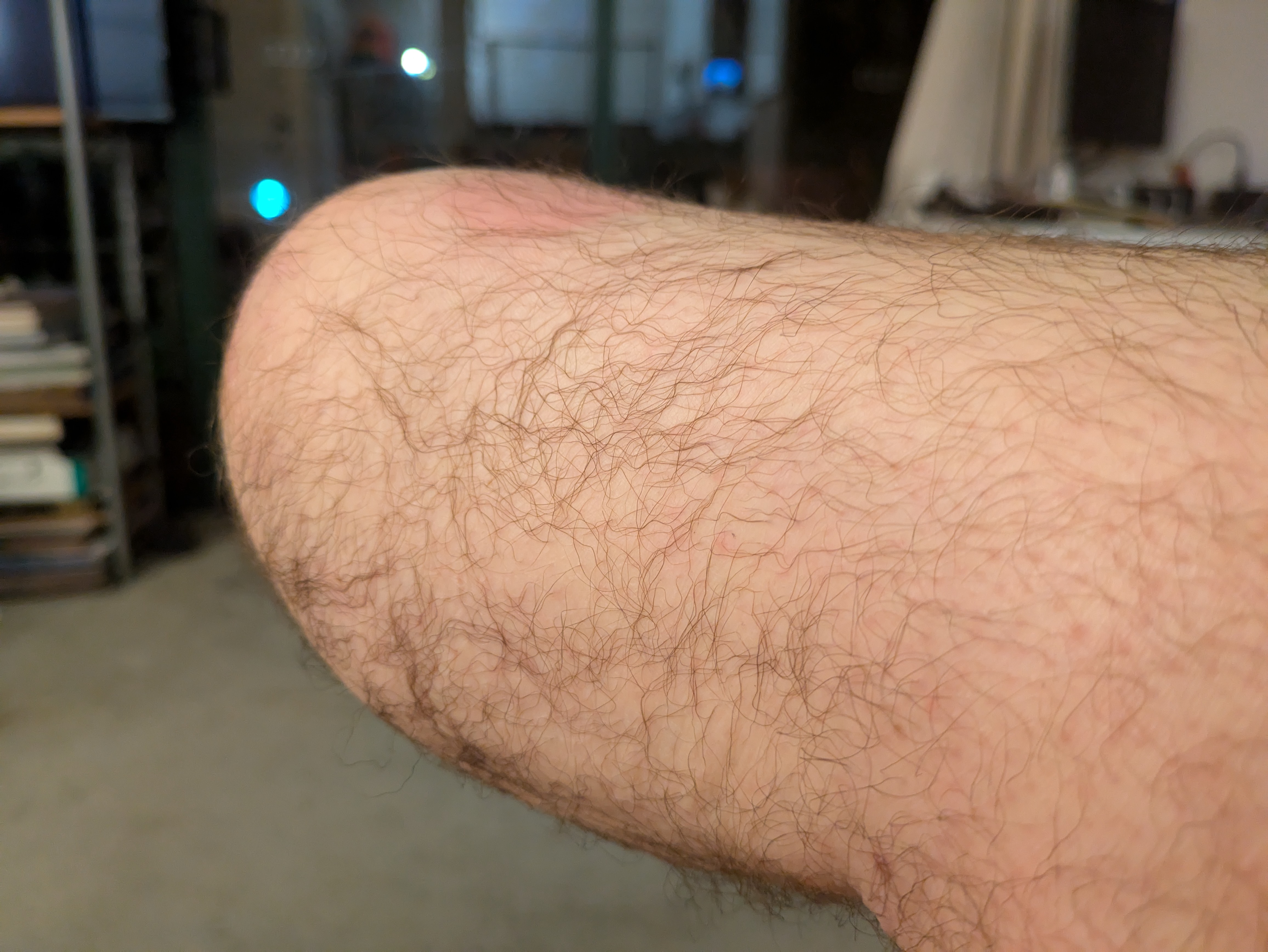 Amputee Massage