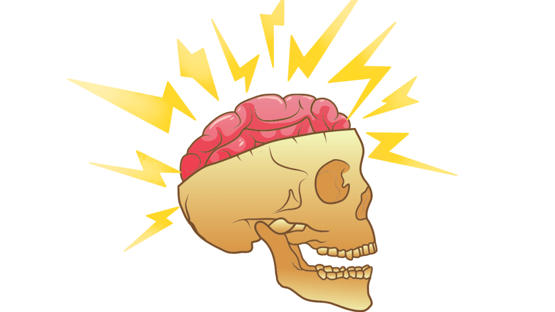 Hypofrontality Hypofrontality