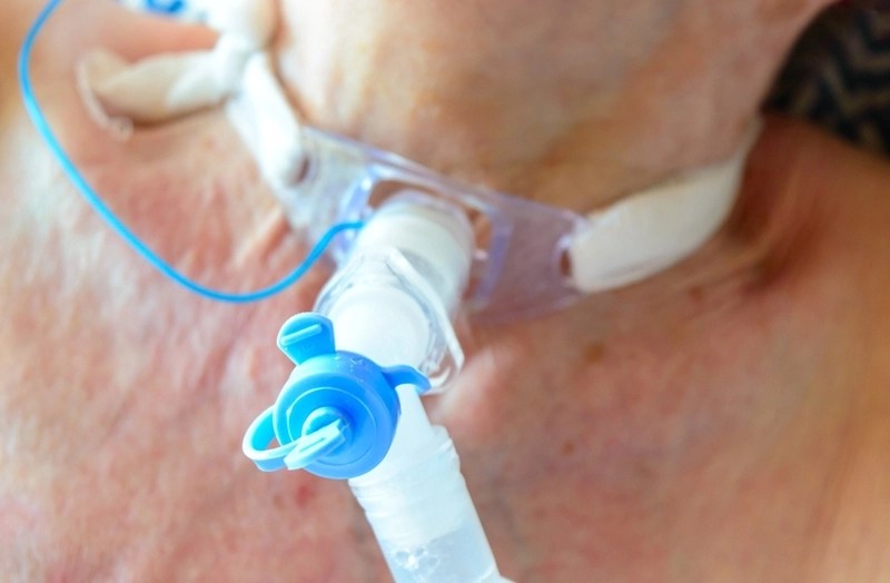Cânula de traqueostomia: quando fazer a troca?