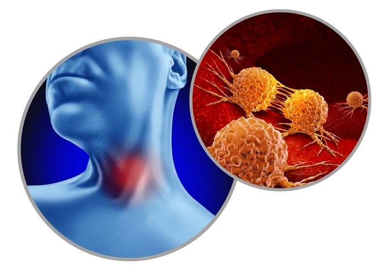 HPV na garganta: prevenção e tratamento