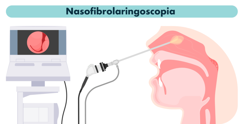 Nasofibrolaringoscopia: o que o exame detecta?