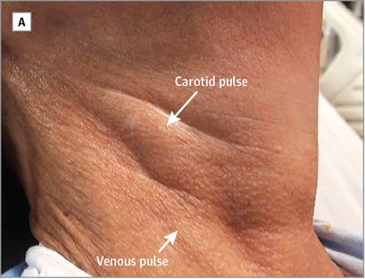 Palpation of the heart and cardiovascular assessment