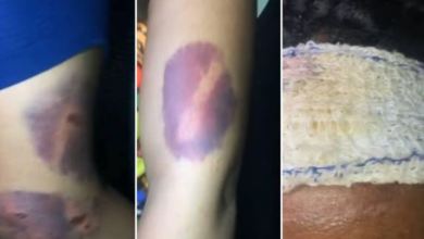 Nigerian Lawyer Rescues 23-Year-Old Woman Allegedly Abused By Boyfriend