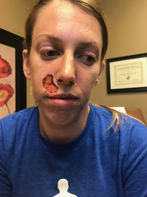 Sign up for a level two package. Before And After Photos Show Reality Of Tanning Beds And Skin Cancer