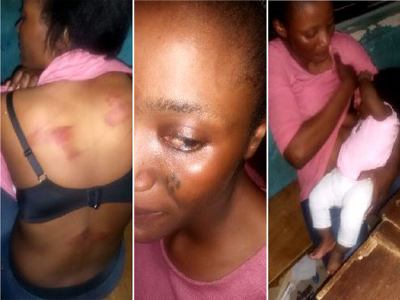 Nursing mother brutalised  at police checkpoint