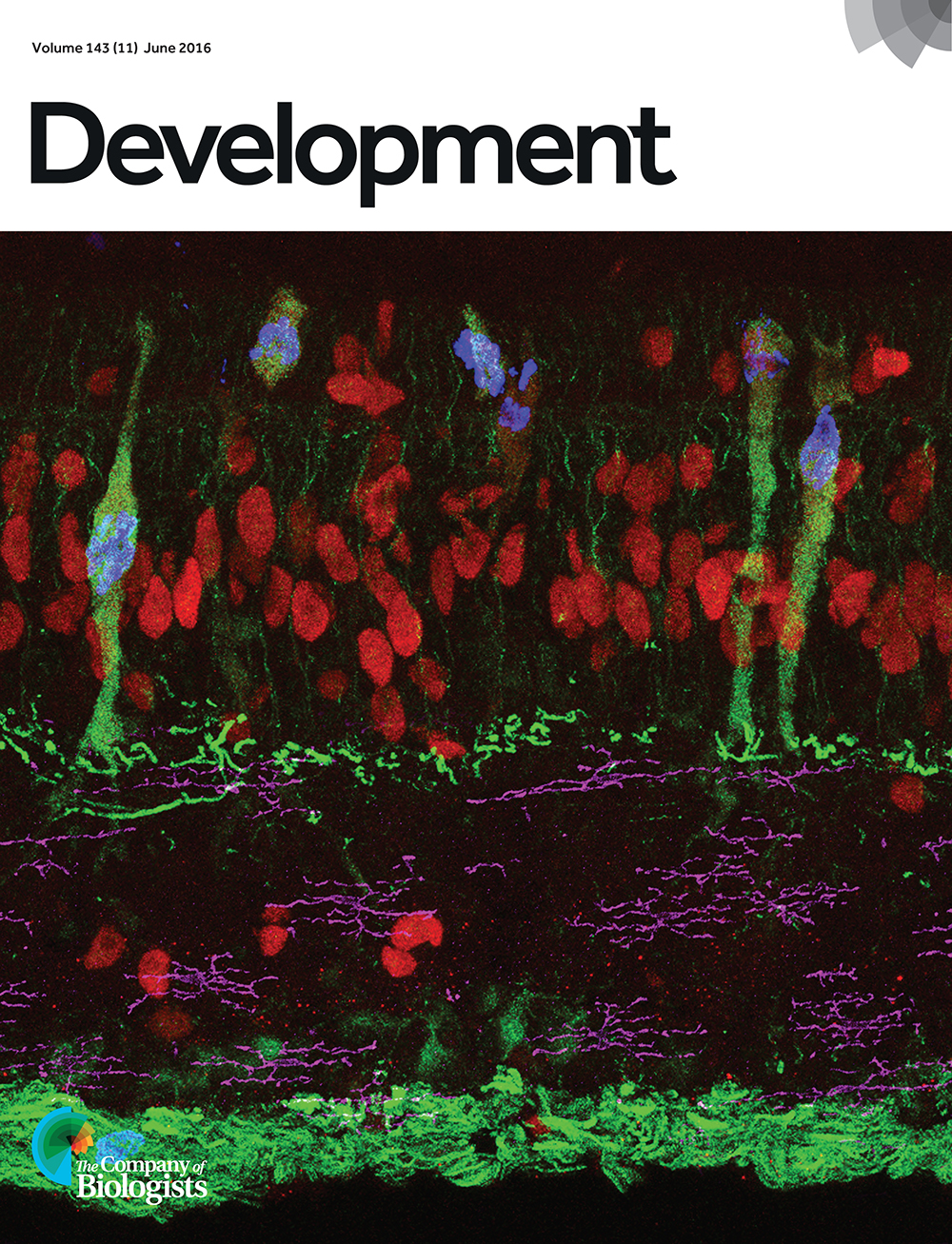 Müller glia-derived progenitor cells in acutely damaged chick retina. The retinal section was labelled with antibodies to Sox9 (red), neurofilament (green), phospho-histone H3 (blue) and CD45 (magenta). From Zelinka et al., p. 1859