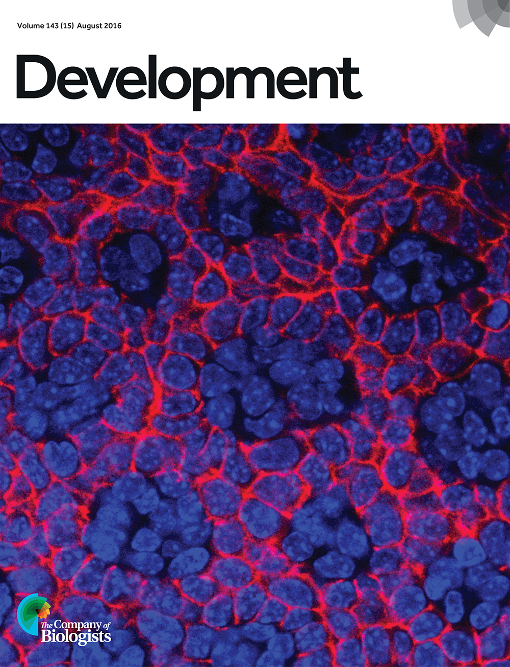 Mouse E16.5 dorsal tongue filiform papillary epithelia are highly patterned as rosettes, ordered between regions of intercalating lamina propria. Epithelium is demarcated by membranously expressed E-cadherin (Rhodamine Red-X); nuclei are stained with DAPI (blue). The mitotic spindle orientation factor LGN has multiple distinct functions in regulating oral epithelial development by controlling cell division orientation. From Byrd et al., p. 2803.