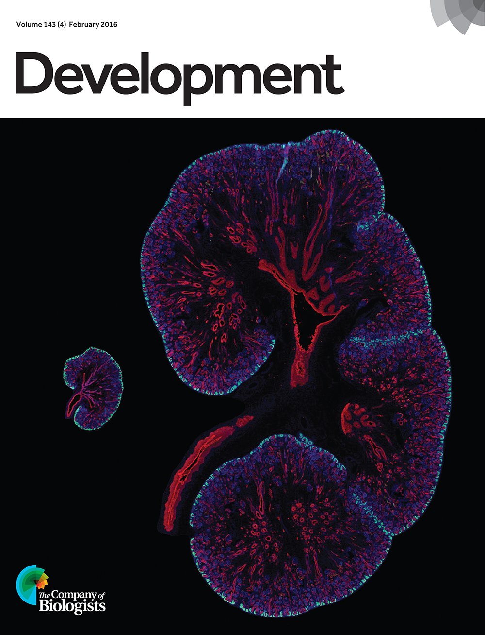 Differing Six2/SIX2 transcriptional networks in mouse and human kidney. E15.5 mouse kidney next to a 15.5 week human fetal kidney with Six2/SIX2 (cyan) marking the nephron progenitors and cytokeratin (red) highlighting the collecting duct system. Nuclei are in blue. From O'Brien et al., p. 595.